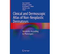 Clinical and Dermoscopic Atlas of Non-neoplastic Dermatoses: Variability According to Phototypes