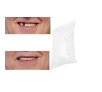 Clip nei denti delle faccette, perline di riparazione temporanea dei denti per denti rotti mancanti Materiale di riempimento dei denti dentali, cemento per denti (10g)