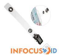 Clip Per Coccodrillo Con Chiusura Metallica E Cinghie In Nylon Pacco Di 100