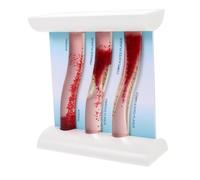 CLISPEED Modello Vascolare Modello Di Vaso Sanguigno Umano Modello Di Vasi Sanguigni Modello Del Circolatorio Modelli Di Anatomia Modello Anatomico Umano Anatomia Umana I Fianchi