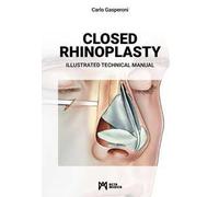 Closed rhinoplasty. Illustrated technical manual
