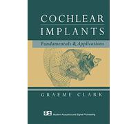 Cochlear Implants: Fundamentals and Applications