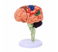 Colcolo Modello del Cervello Umano con Parti Staccabili E Rimontabili con Rappresentazione Minuziosa delle Vie Esterne Ed Intern Cervello Cervelletto con