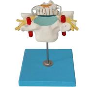 Colonna vertebrale cervicale umana con midollo spinale e modello di ingrandimento del nervo spinale, modello anatomico morfologico della vertebra cervicale