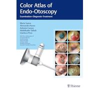 Color Atlas of Endo-Otoscopy: Examination-Diagnosis-Treatment by Sanna, Mario
