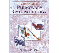 Color Atlas of Pulmonary Cytopathology