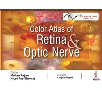 Color Atlas of Retina and Optic Nerve