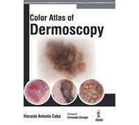 Colour Atlas of Dermoscopy