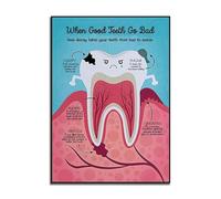 Come La Carie Può Far Passare I Denti Da Cattivi A Cattivi Poster, Decorazione Dello Studio Dentistico, Arte Da Parete Con Denti Cattivi Quando I Denti Buoni Vanno Male 50Cmx70Cm Senza Telaio