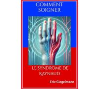 Comment soigner le syndrome de Raynaud
