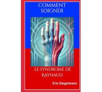 Comment soigner le syndrome de Raynaud