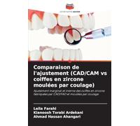 Comparaison de l'ajustement (CAD/CAM vs coiffes en zircone moulées par coulage): Ajustement marginal et interne des coiffes en zircone fabriquées par CAO/FAO et moulées par coulage