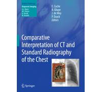Comparative Interpretation of CT and Standard Radiography of the Chest