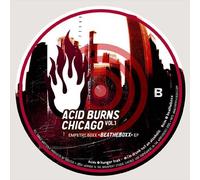 Compilation - Acid Burns Chicago