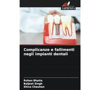 Complicanze e fallimenti negli impianti dentali