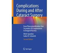 Complications During and After Cataract Surgery: From Phacoemulsification over Secondary Iol Implantation to Dropped Nucleus