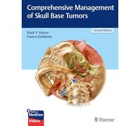 Comprehensive Management of Skull Base Tumors