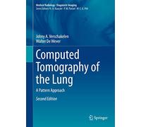 Computed Tomography of the Lung: A Pattern Approach