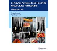 Computer Navigated and Handheld Robotic Knee Arthroplasty: An Illustrative Guide