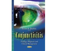 Conjunctivitis: Etiology, Diagnosis and Clinical Management