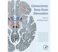 Connectomic Deep Brain Stimulation
