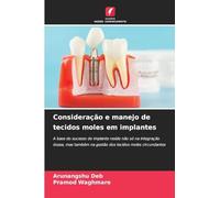 Consideração e manejo de tecidos moles em implantes: A base do sucesso do implante reside não só na integração óssea, mas também na gestão dos tecidos moles circundantes