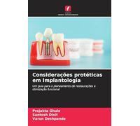 Considerações protéticas em Implantologia: Um guia para o planeamento de restaurações e otimização funcional