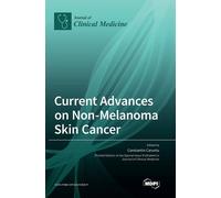 Constantin Carunt Current Advances on Non-Melanoma Skin Cance (Copertina rigida)