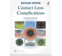 Contact Lens Complications