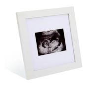 Cornice per foto con ecografia per bambini, 3,5 x 2,5 cm, cornice in legno per annuncio di gravidanza, decorazione per genitori in attesa, baby shower, genere R