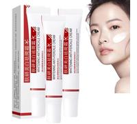 Crema Manchas, Crema Para Manchas Oscuras En La Cara, Cremas Para Quitar Manchas De La Cara, Crema Para Las Manchas De La Cara, Crema per le imperfezioni del tono della pelle (3 pezzi)