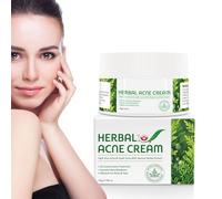 Crema per Acne, Crema Punti Neri per Pelle Grassa e Mista, Lozione Idratante Viso Anti Acne, Adatta a Tutti i Tipi di Pelle, per l'Acne
