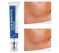 Crema Per Cicatrici Da Ustioni,30g Prodotto Cura Macchie Scottatura - Crema Schiarente Per Cicatrici Vecchie,Per Donne e Uomini Routine Quotidiana Ginocchia Gomiti Ustioni Cheloidi Recupero Infortuni