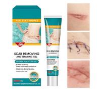 Crema Per La Rimozione Delle Cicatrici - 20 Grammi Lenitivo | Cura Delle Cicatrici A Lungo Termine | Per Recupero Conforto Infortuni Domestici Ustioni Personali Benessere Protezione