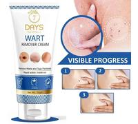 Crema per la rimozione delle verruche genitali 7 giorni per uomo e donna 50 g...