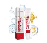 Crema per lentiggini, crema per eliminare cicatrici da acne, crema per macchie scure dal viso, creme per rimuovere le macchie dal viso, crema per rimuovere la pigmentazione del