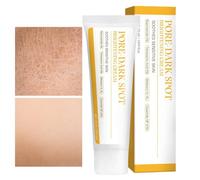 Crema Schiarente Per La Pelle | Lozione Per La Riparazione Dei Pori 30 ml | Crema Schiarente Per La Pelle Del Viso | Per Donne E Uomini Per Attenuare Le Cicatrici E Donare Luminosità