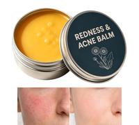 Crema Viso Balsamo Formula Idratante Lenitivo Rinfrescante Nutriente e | Crema per il Corpo per Viso Lenitivo Idratante Quotidiano da Viaggio Uomo Donna
