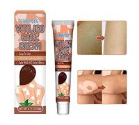Crema vitiligine - 20 g di crema vitiligine-rigenerante, sollievo e rimozione - crema rimozione vitiligine, crema rigenerante, riduce le macchie bianche e migliora il lingjiong
