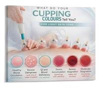 Cupping Poster Skin Reaction Chart TCM Reference