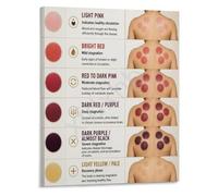 Cupping Poster Skin Reaction Chart TCM Reference
