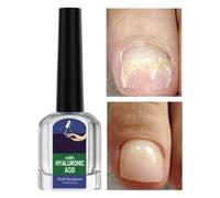 Cura delle unghie con acido ialuronico - Soluzione di olio di jojoba con vitamina E Siero rinforzante, trattamento idratante riparatore per unghie | Riduce la fragilità promuove una crescita sana per