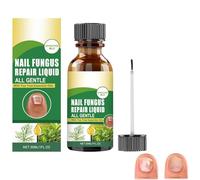 Cura e trattamento delle unghie, riparazione delle unghie, cura delle unghie, per mani e piedi sani, olio per unghie, olio per la cura delle unghie, cura delle unghie, per unghie rotte e scolorite
