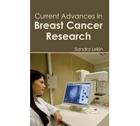 Current Advances in Breast Cancer Research (Copertina rigida)