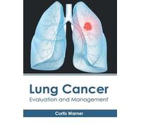 Curtis Warner Lung Cancer: Evaluation and Management (Copertina rigida)