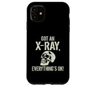 Custodia per iPhone 11 Ho fatto una radiografia, è tutto ok. La radiografia dice
