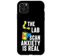 Custodia per iPhone 11 Pro Max Film Photography The Lab Scan Anxiety Is Real Analog