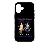 Custodia per iPhone 16 What You See What I Feel Skeleton Fibromyalgia Awareness