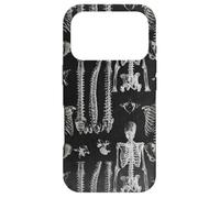 Custodia per iPhone 17 Pro Design ortopedico a tema anatomico scheletrico della spina dorsale