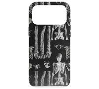 Custodia per iPhone 17 Pro Max Design ortopedico a tema anatomico scheletrico della spina dorsale